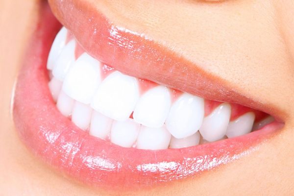 Teeth-Whitening.jpg.optimal