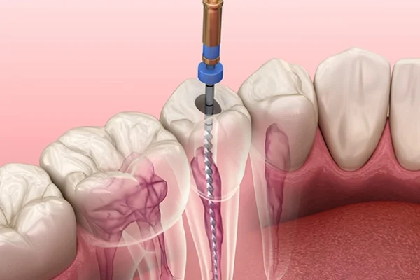 img-Periodontics
